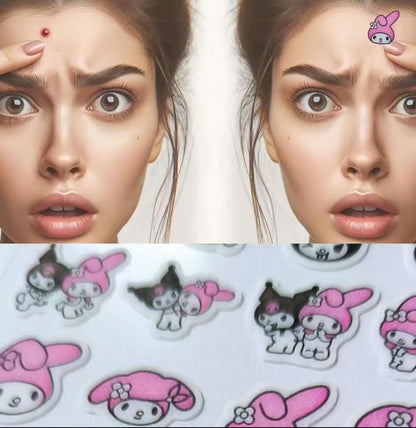 PARCHES PARA ACNE SANRIO
